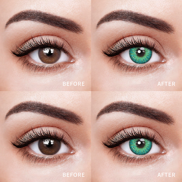 Comparison of the Effects Before and After Wearing Forest Spark Green Contact Lenses